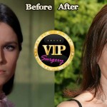 Barbara Hershey before and after Plastic Surgery