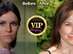 Barbara Hershey before and after Plastic Surgery