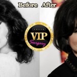 Delta Burke before and after plastic surgery