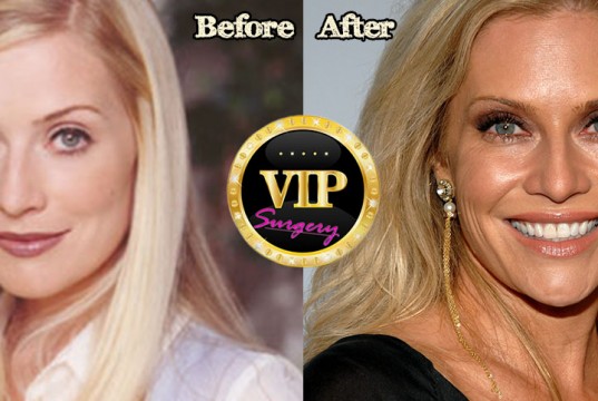 Emily Procter plastic surgery