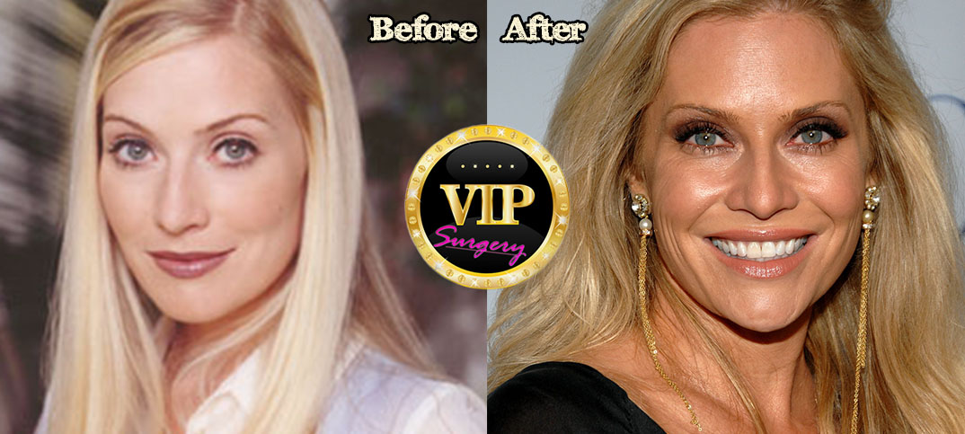 Emily Procter plastic surgery. 