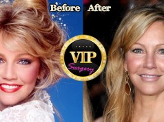 Heather Locklear plastic surgery
