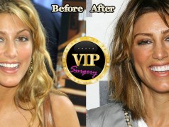 Jennifer Esposito plastic surgery