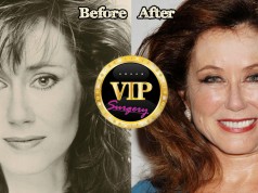 Mary Mcdonnell plastic surgery