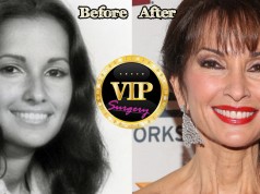 Susan Lucci plastic surgery