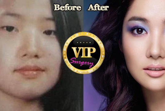 park min young plastic surgery