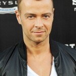Joey lawrence forehead reduction