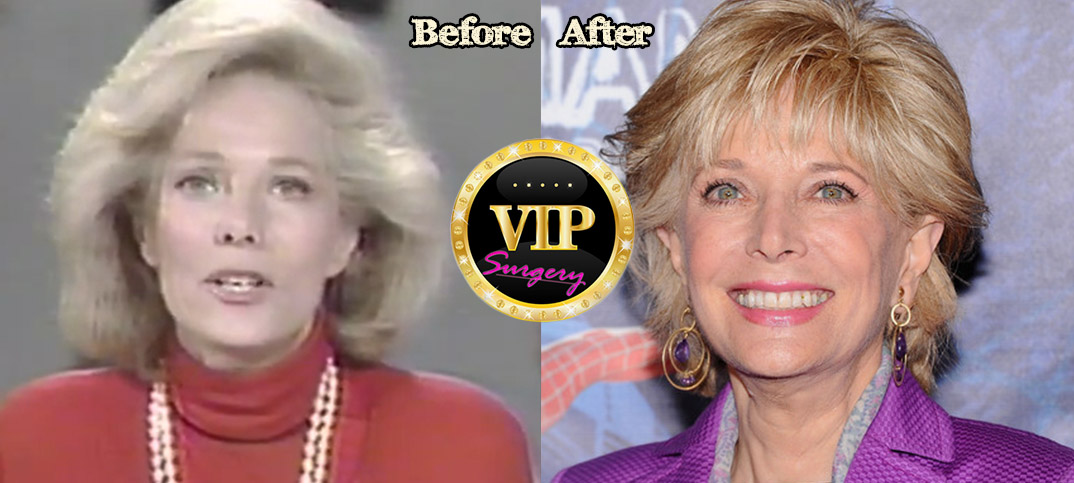 Lesley Stahl young.