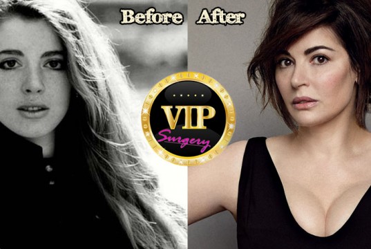 Nigella Lawson Plastic Surgery