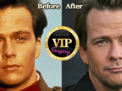 Sean Patrick Flanery Plastic Surgery