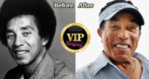 Smokey Robinson before and after Plastic Surgery