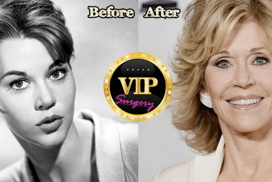 jane fonda plastic surgery