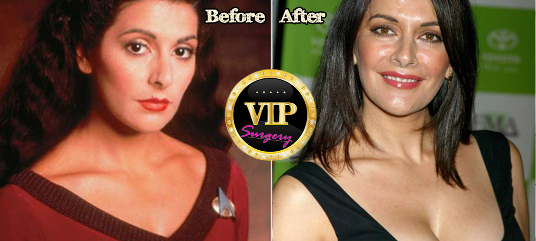 marina sirtis plastic surgery. 