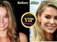 jennifer hawkins plastic surgery