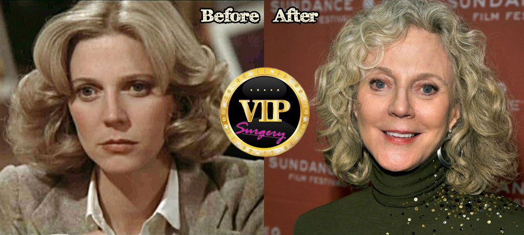 Blythe danner young pictures