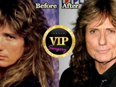 David Coverdale Plastic Surgery