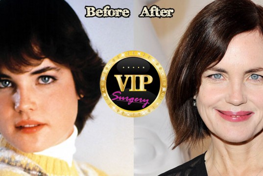 Elizabeth McGovern Plastic Surgery