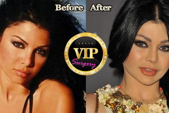 Haifa Wehbe Plastic Surgery