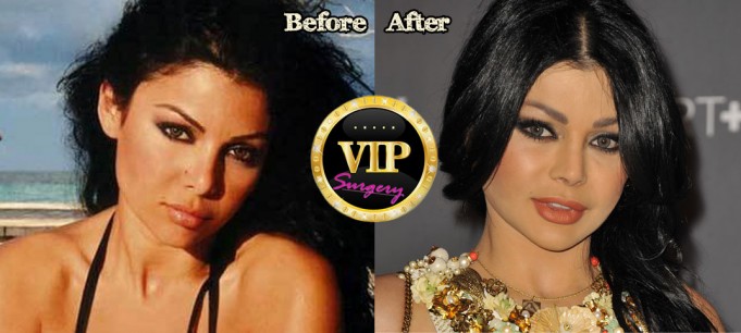 Haifa Wehbe Plastic Surgery