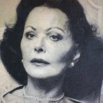 Hedy Lamarr After Plastic Surgery