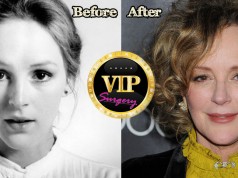 Bonnie Bedelia Facelift