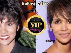 Halle Berry Nose Job
