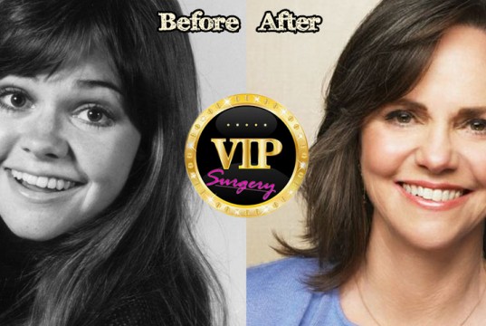 Sally Field Plastic Surgery