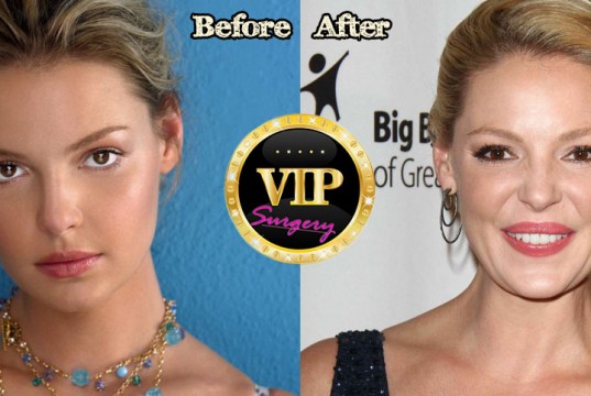 Katherine Heigl Plastic Surgery