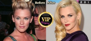 Jenny Mccarthy Plastic Surgery Before and After Pictures