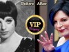 Liza Minnelli Plastic Surgery