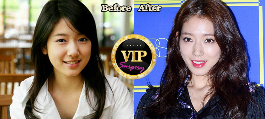 Park Shin Hye Plastic Surgery Before and After Pictures