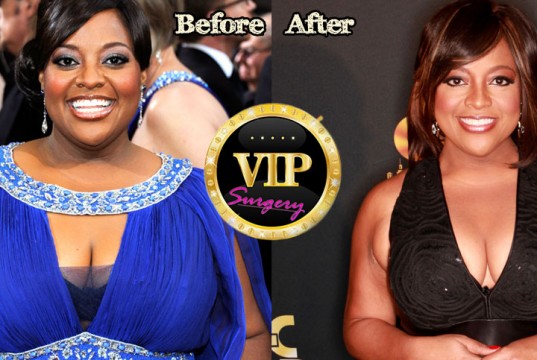 Sherri Shepherd Breast Reduction