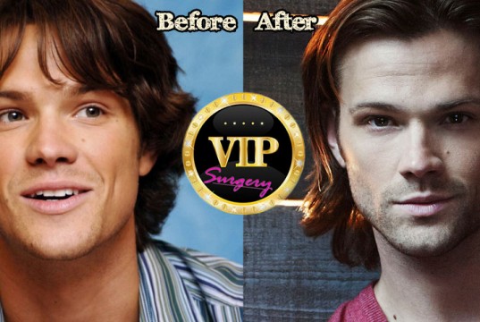 Jared Padalecki Nose Job