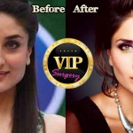 Kareena Kapoor Plastic Surgery