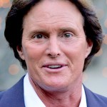 Bruce Jenner Before and after Photos