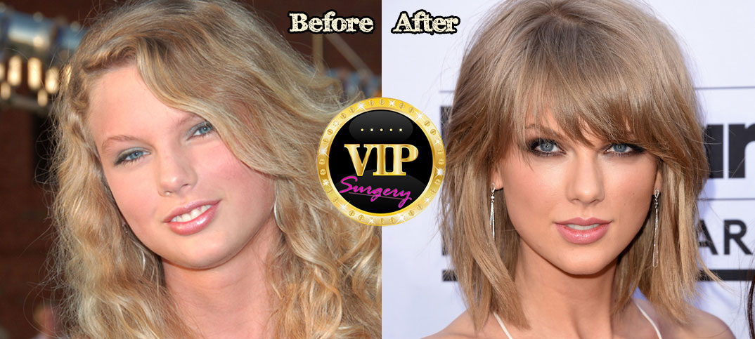 taylor swift before and after nose job